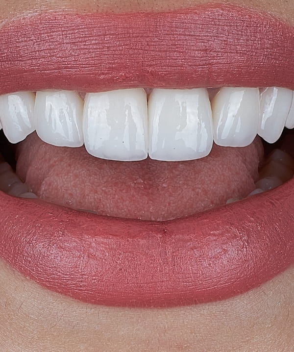 Treatments - Khan Dental