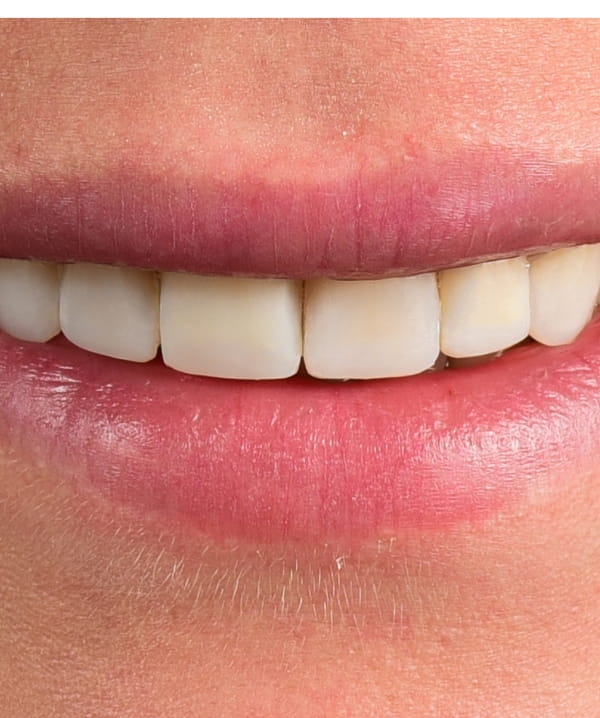 Treatments - Khan Dental