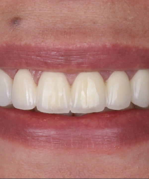 Treatments - Khan Dental