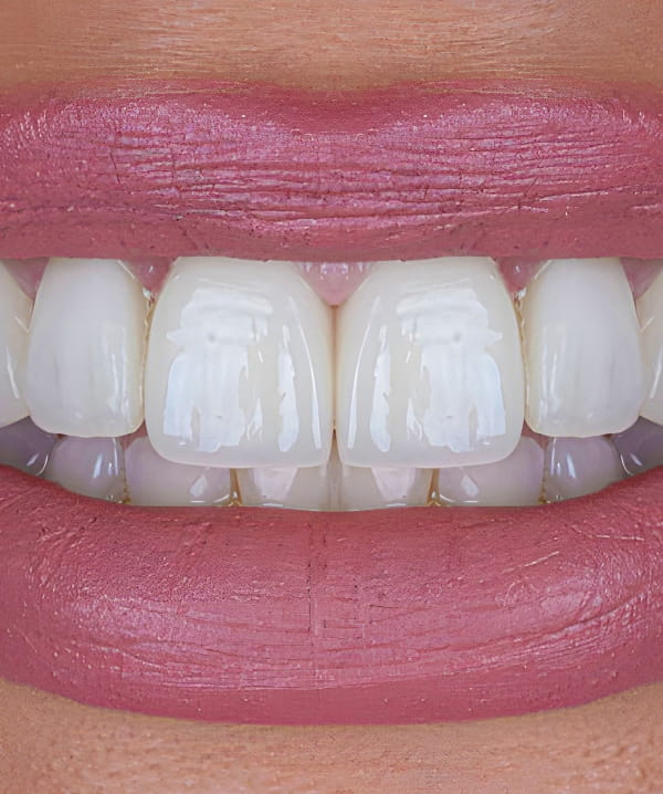 Treatments - Khan Dental