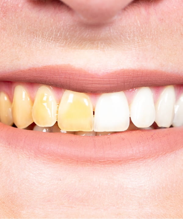 Treatments - Khan Dental